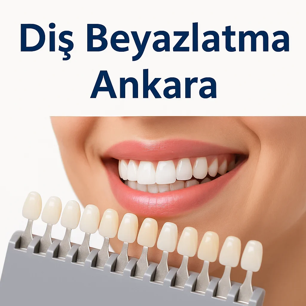Dis Beyazlatma Ankara – En Güncel ve Kapsamlı Rehber 5 dis beyazlatma ankara