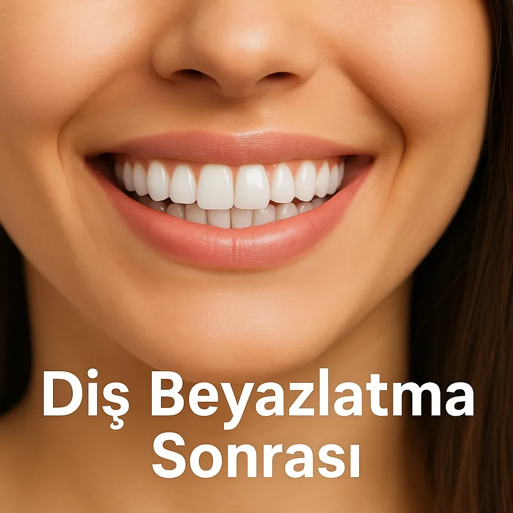 Diş Beyazlatma Sonrası Nelere Dikkat Edilmeli? 5 dis beyazlatma sonrasi