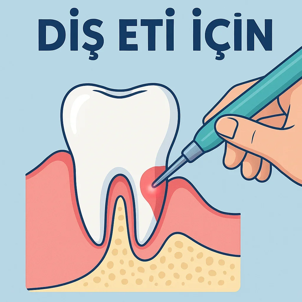 Diş Eti İçin En İyi Çözümler ve Bilmeniz Gerekenler 5 dis eti icin