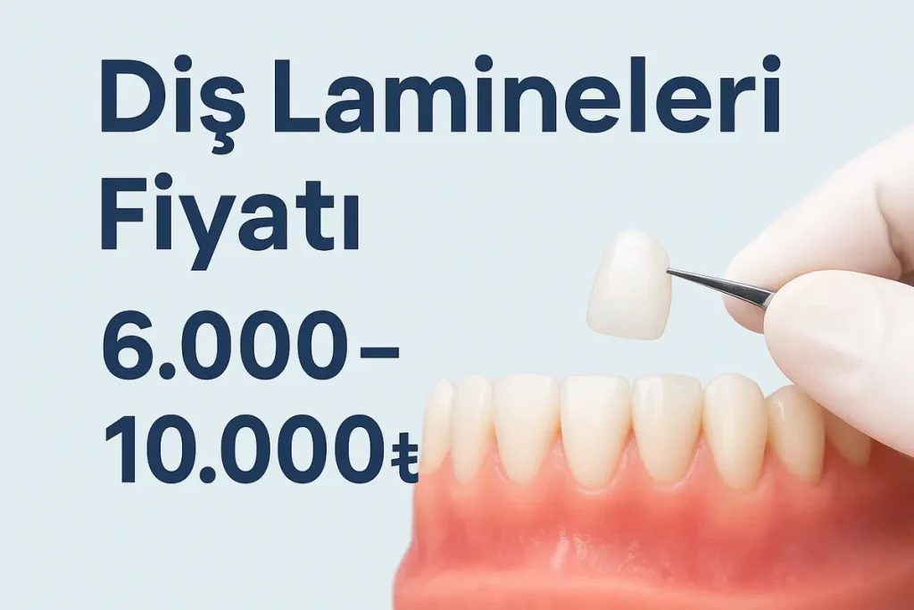 dis laminesi fiyati: 2025 Güncel ve Kapsamlı Bilgilendirme 4 dis laminesi fiyati