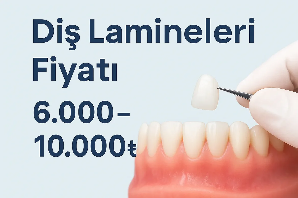 dis laminesi fiyati: 2025 Güncel ve Kapsamlı Bilgilendirme 5 dis laminesi fiyati