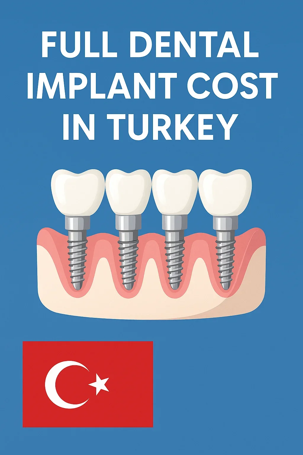 Full Dental Implant Cost in Turkey: Complete Guide 5 full dental implant cost in turkey