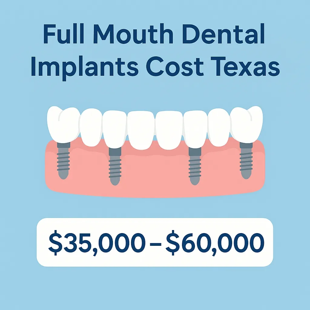 Full Mouth Dental Implants Cost Texas: Complete 2025 Guide
