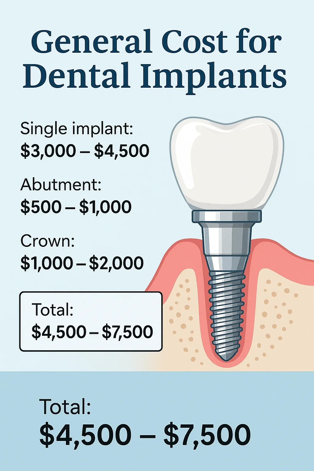 General Cost for Dental Implants 5 general cost for dental implants