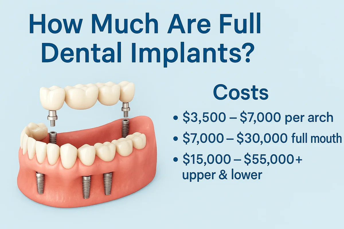 How Much Are Full Dental Implants: Complete Cost Breakdown 5 how much are full dental implants