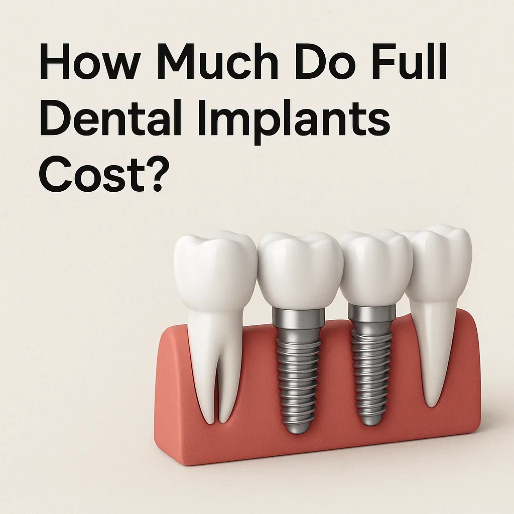 How Much Do Full Dental Implants Cost? 5 how much do full dental implants cost