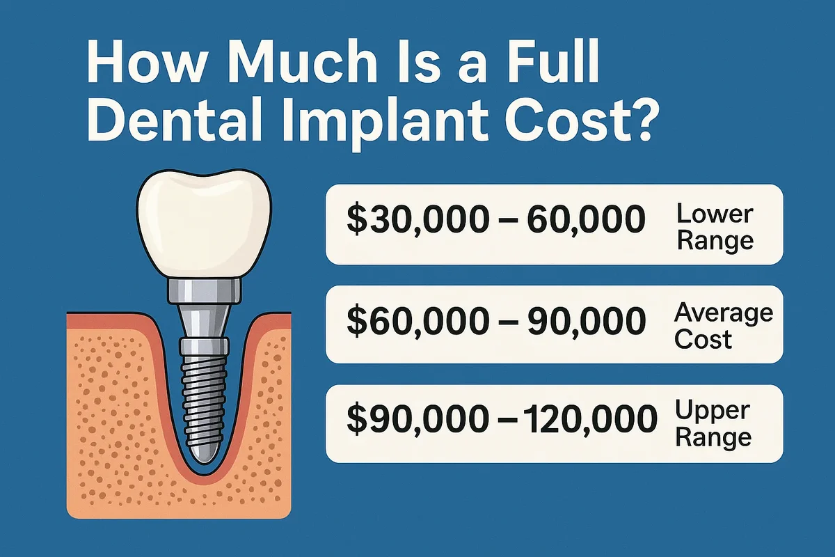 How Much Is a Full Dental Implant Cost? Complete 2025 Guide