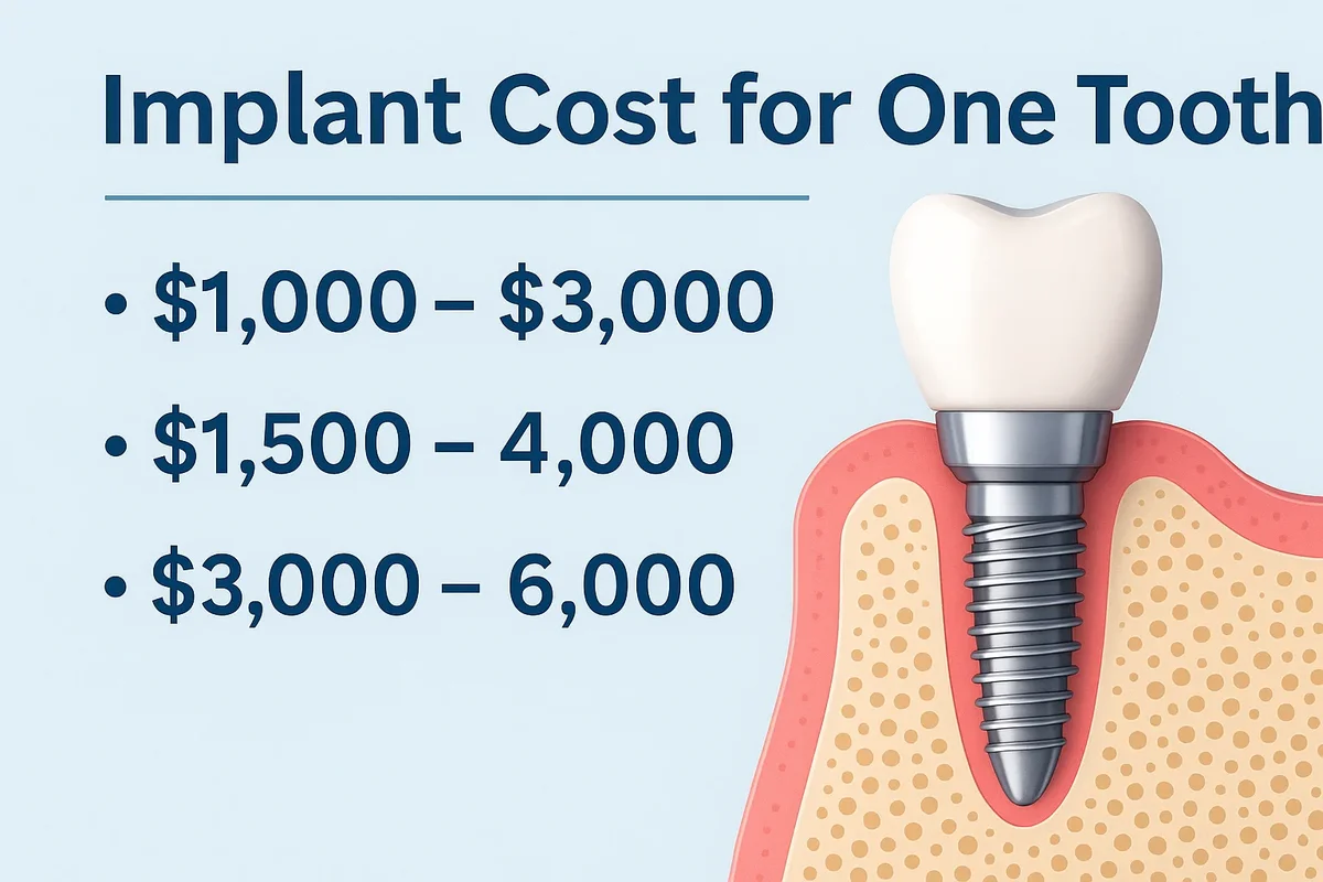 Implant Cost for One Tooth: Complete Guide 2025 đŠ· 5 implant cost for one tooth