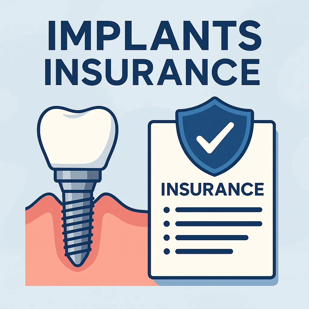 Implants Insurance: Complete Guide for Patients 5 implants insurance