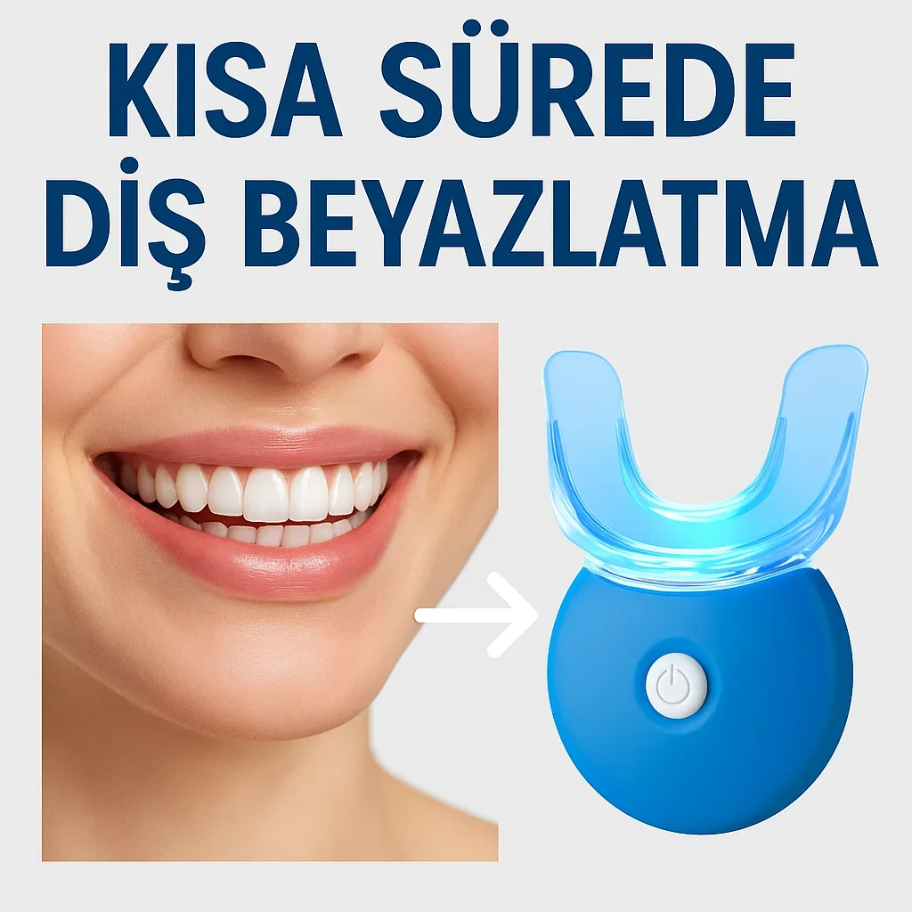 Kısa Sürede Diş Beyazlatma: En Etkili ve Bilimsel Yaklaşımlar 5 kisa surede dis beyazlatma