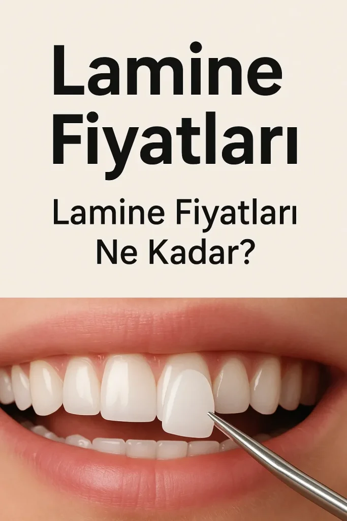 Lamine Fiyatları Nedir ve 2025’te Nasıl Belirlenir? 4 lamine fiyatlari