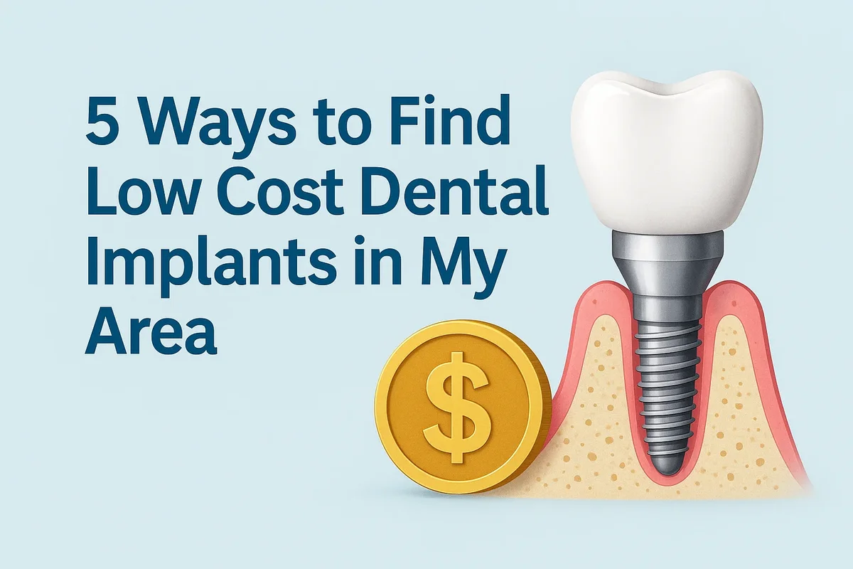Low Cost Dental Implants in My Area: Complete Guide 5 low cost dental implants in my area