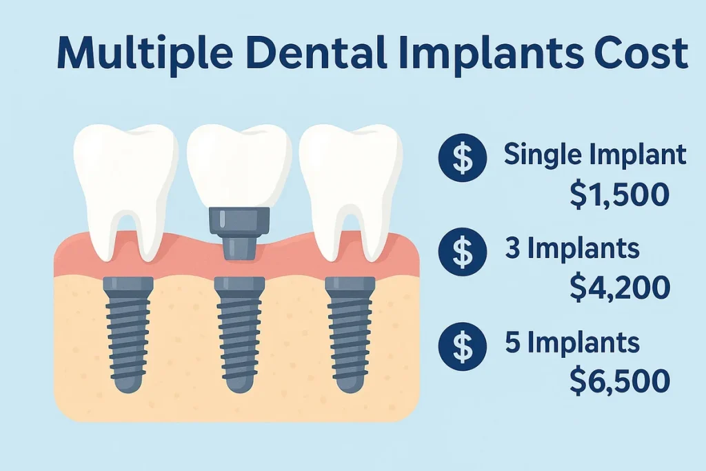 Multiple Dental Implants Cost: Complete 2025 Price Guide 🦷 4 multiple dental implants cost
