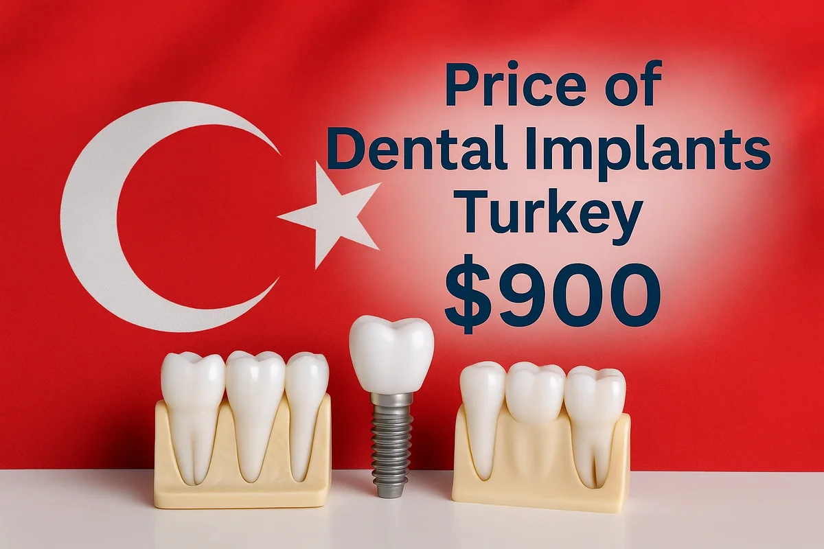 Price of Dental Implants Turkey: Complete 2025 Guide 5 price of dental implants turkey