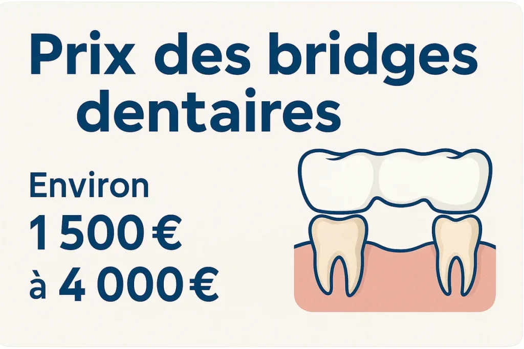 Prix des bridges dentaires 4 prix des bridges dentaires
