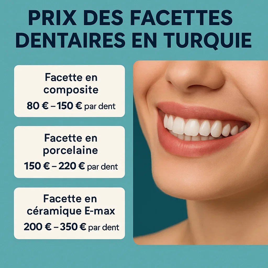 Prix des facettes dentaires en Turquie 5 prix des facettes dentaires en turquie