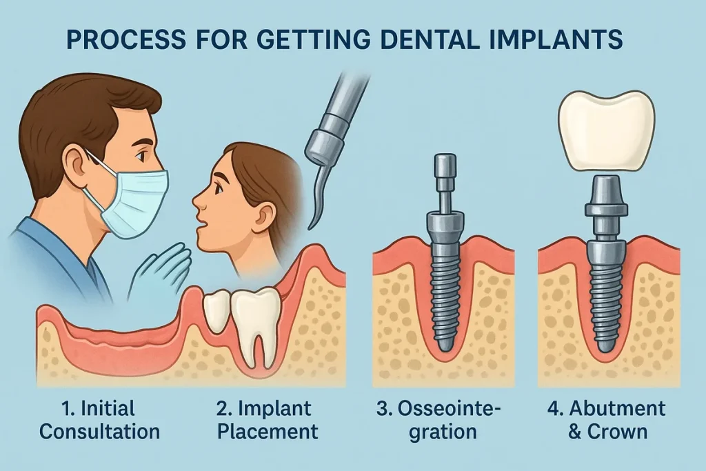 Process for Getting Dental Implants: Complete Step-by-Step Guide 4 process for getting dental implants