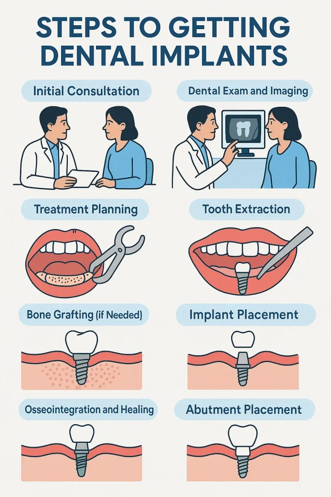 Steps to Getting Dental Implants: A Complete Guide 4 steps to getting dental implants