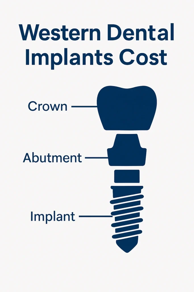 Western Dental Implants Cost: Complete 2025 Guide 4 western dental implants cost