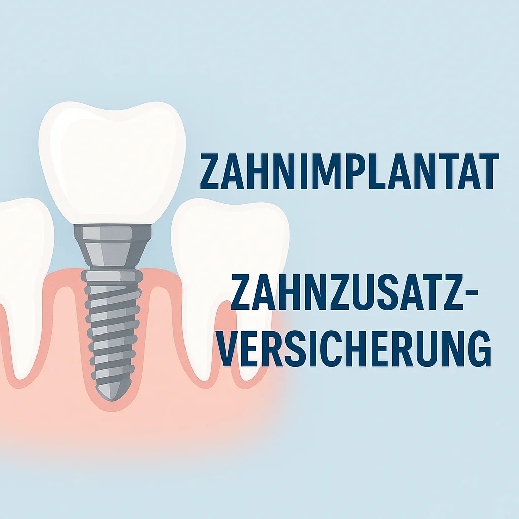Zahnimplantat Zahnzusatzversicherung – Dein umfassender Leitfaden 2025 5 zahnimplantat zahnzusatzversicherung