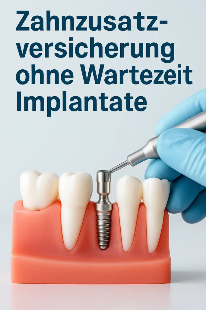 Zahnzusatzversicherung ohne Wartezeit Implantate – Alle Fakten 4 zahnzusatzversicherung ohne wartezeit implantate