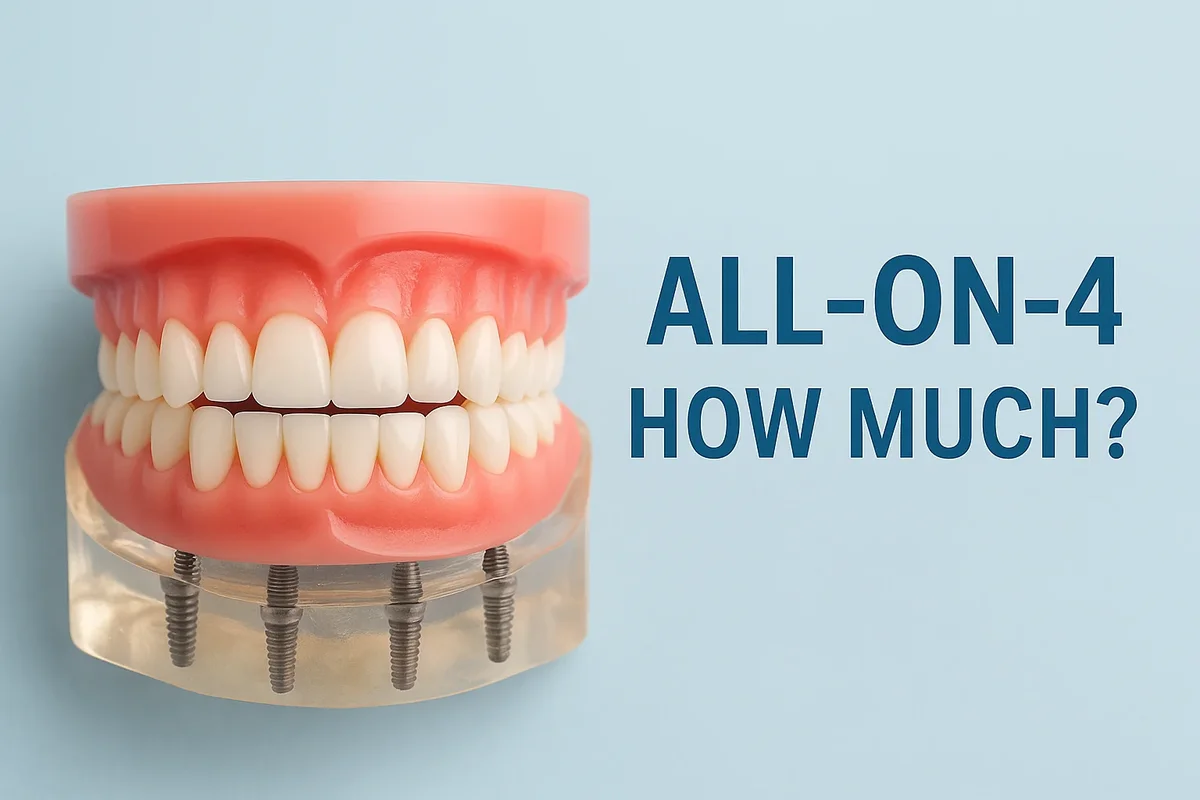 All on 4 How Much: A Complete Cost Guide for Patients 5 all on 4 how much