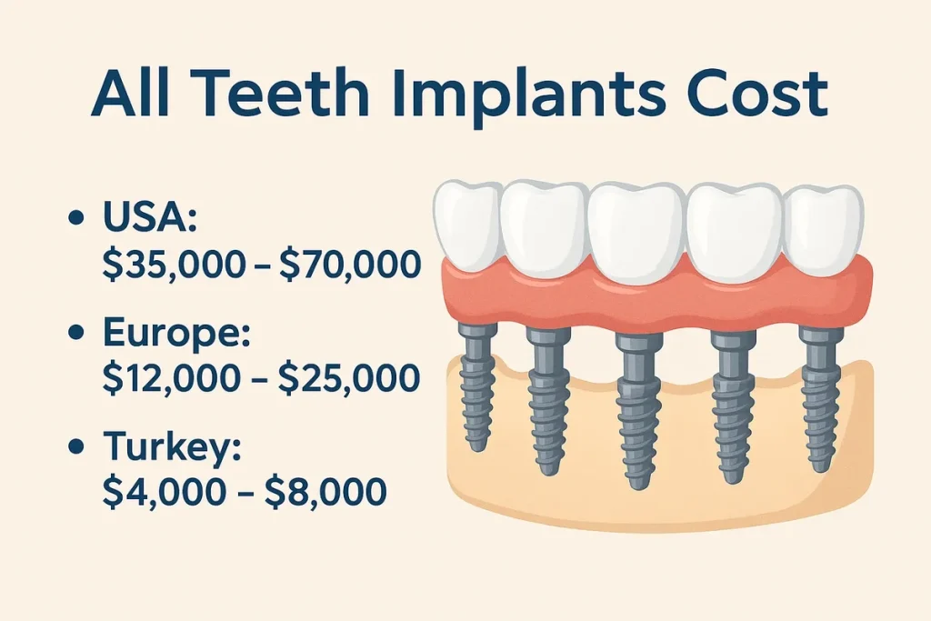All Teeth Implants Cost: Complete Pricing Guide 4 all teeth implants cost