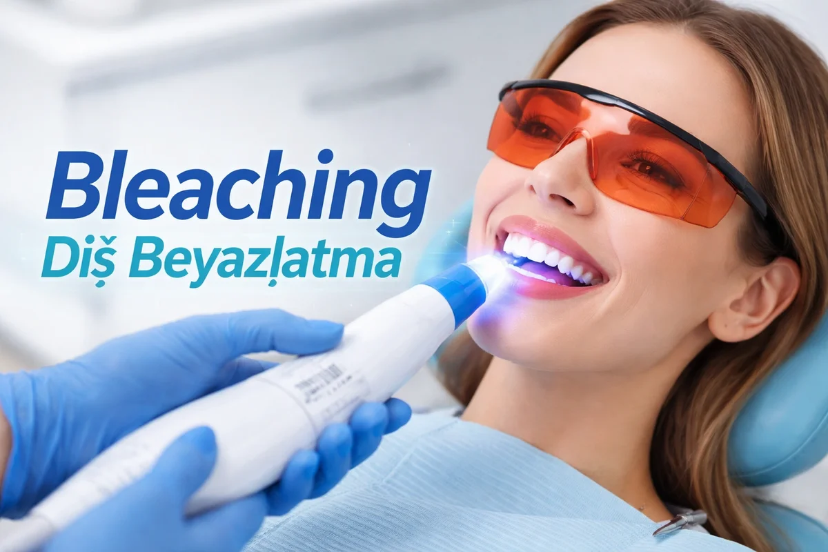 Bleaching Diş Beyazlatma Nedir ve Nasıl Uygulanır? 5 bleaching dis beyazlatma