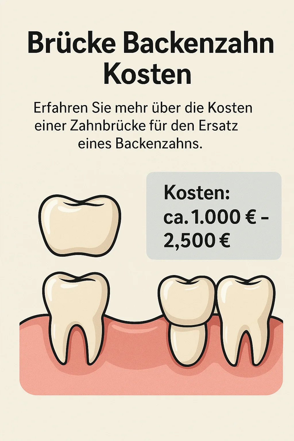 Brücke Backenzahn Kosten: Alle wichtigen Faktoren im Überblick 5 brücke backenzahn kosten