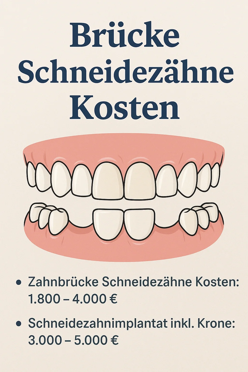 Brücke Schneidezähne Kosten – was Patienten wirklich wissen müssen 5 brücke schneidezähne kosten