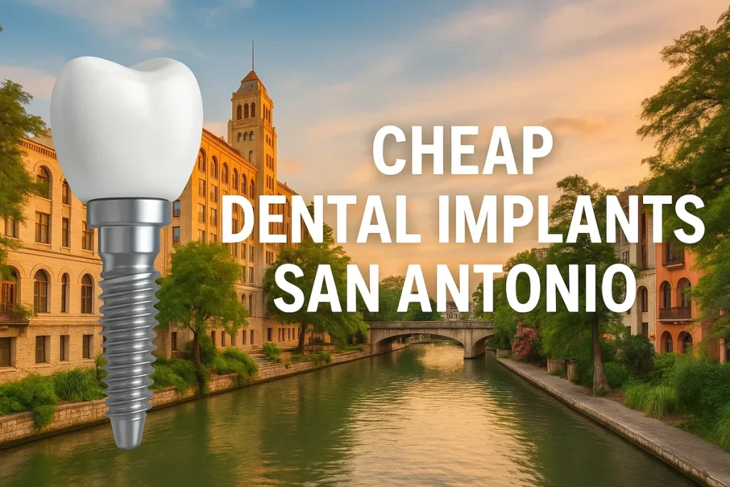 Cheap Dental Implants San Antonio 4 cheap dental implants san antonio