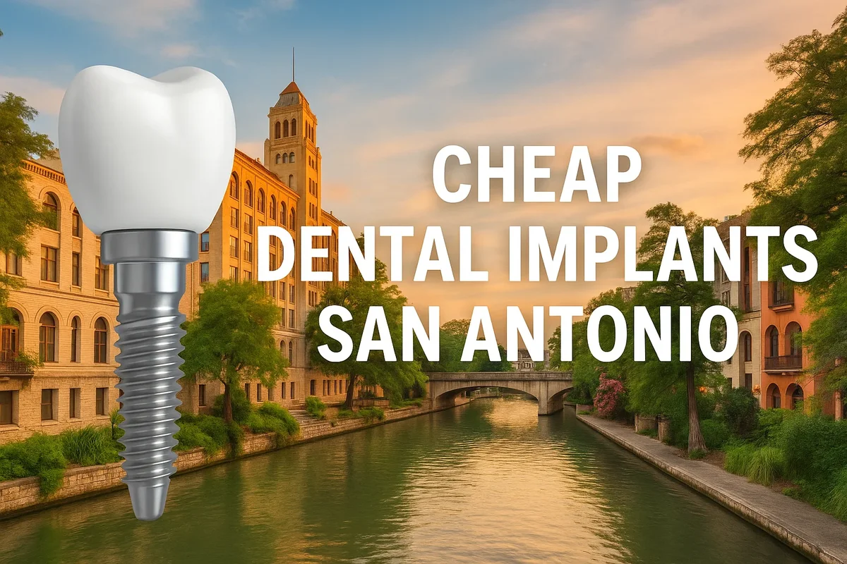 Cheap Dental Implants San Antonio 5 cheap dental implants san antonio