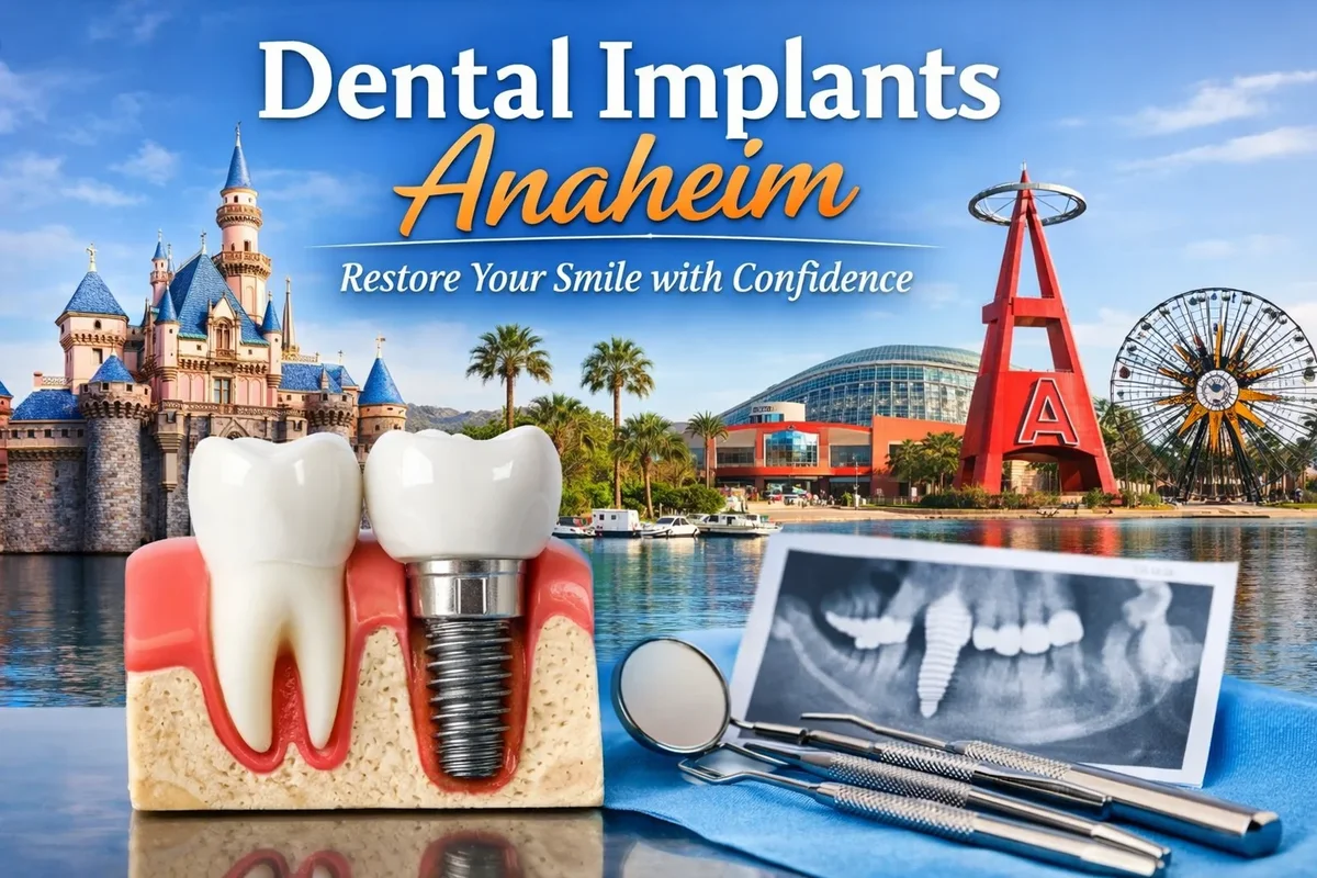 dental implants anaheim