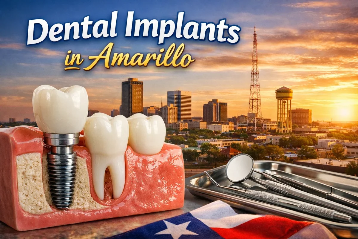 dental implants in amarillo