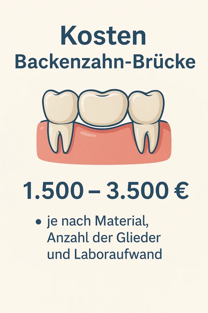 Kosten Backenzahn Brücke – kompletter Leitfaden 2025 4 kosten backenzahn brücke