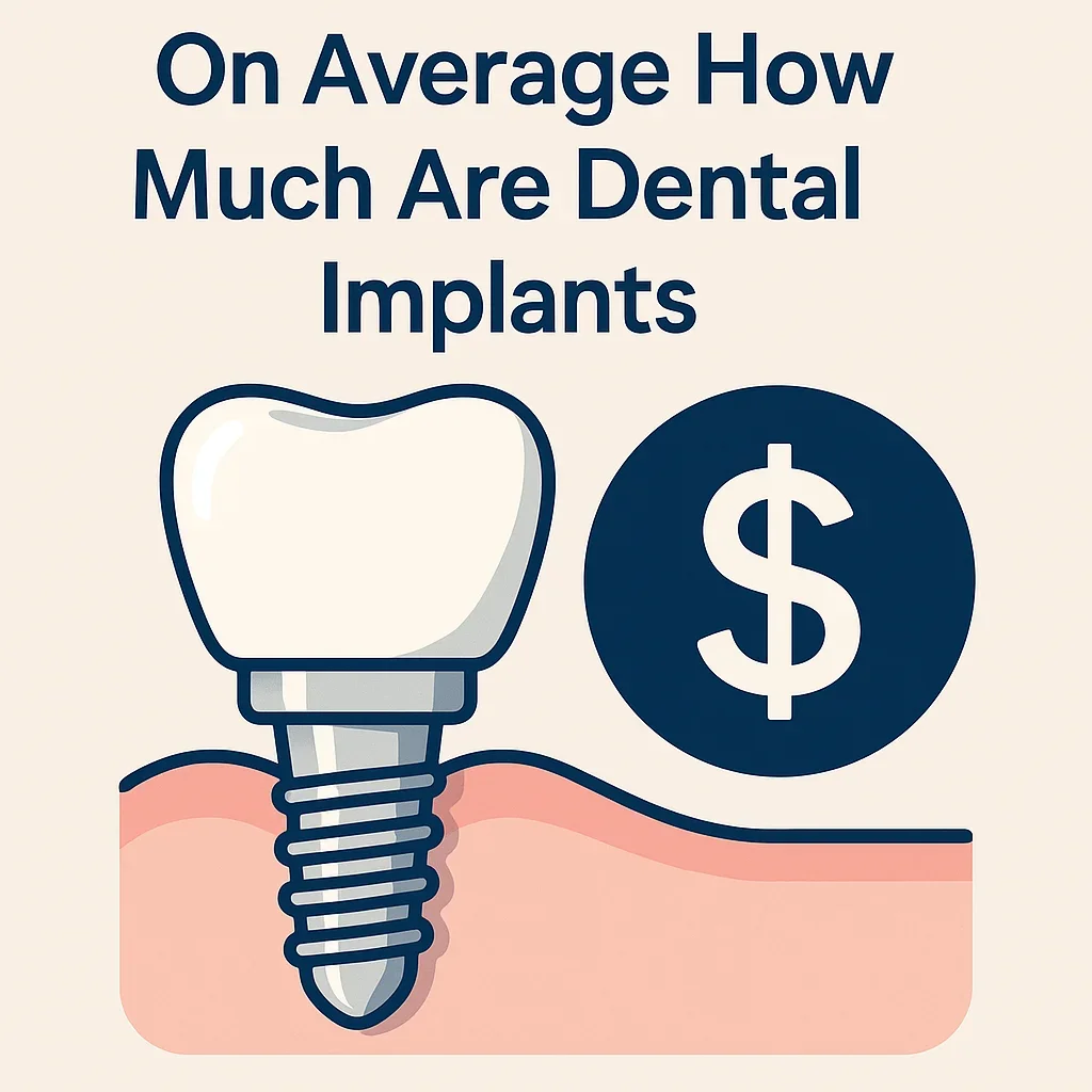 On Average How Much Are Dental Implants? 5 on average how much are dental implants