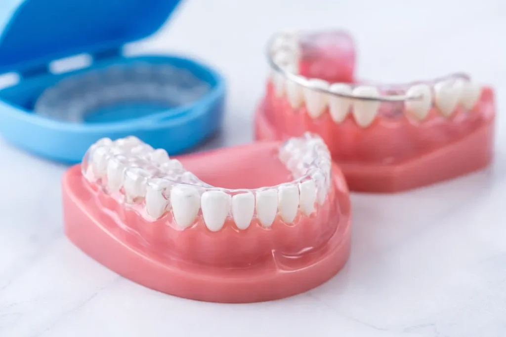 Ortodontik Retainer Nedir ve Ne İşe Yarar? 4 ortodontik retainer