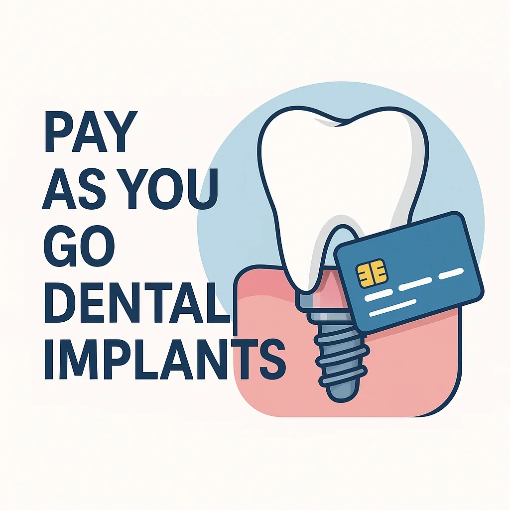 Pay As You Go Dental Implants: A Flexible Way to Restore Your Smile 5 pay as you go dental implants