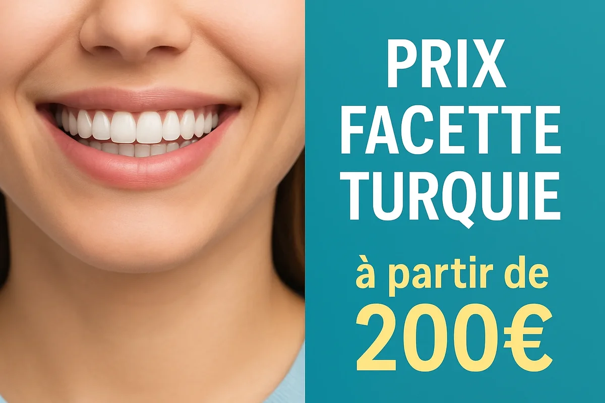 prix facette turquie