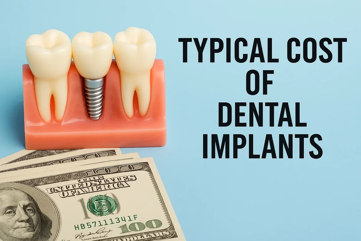 Typical Cost of Dental Implants: Complete 2025 Guide