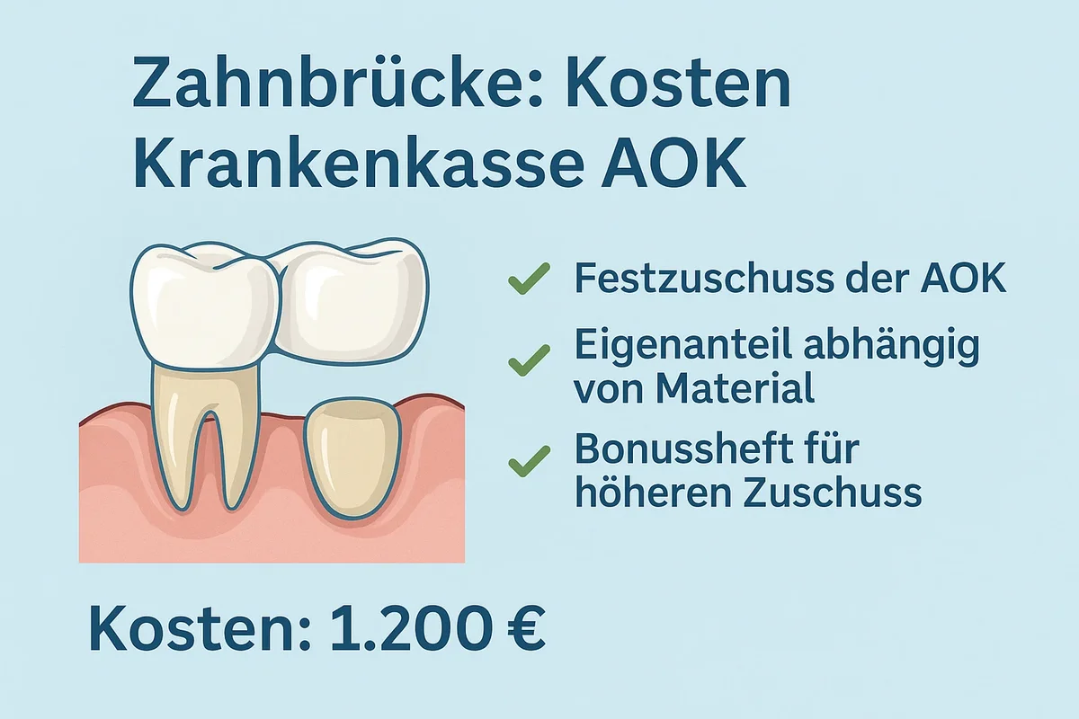zahnbrücke kosten krankenkasse aok – Alles, was Sie wirklich wissen müssen 5 zahnbrücke kosten krankenkasse aok