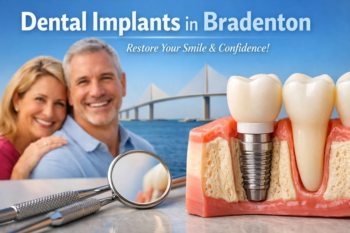 Dental Implants in Bradenton: A Complete Guide for Patients 5 dental implants in bradenton