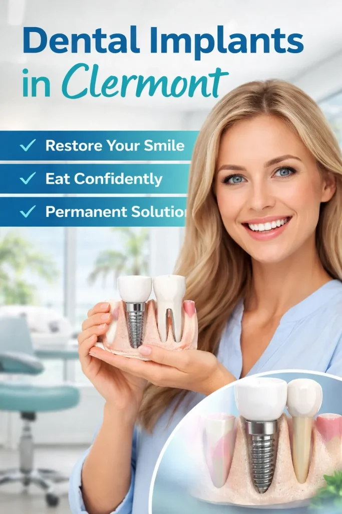Dental Implants in Clermont: A Complete Patient Guide 4 dental implants in clermont