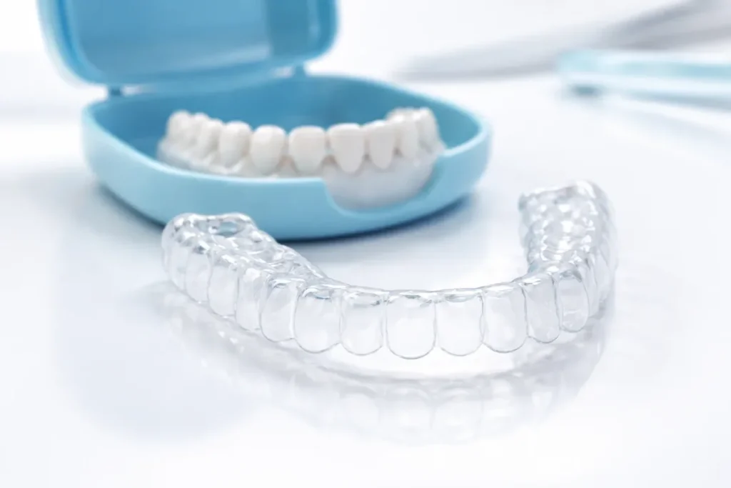 Essix Retainer: Complete Guide for Long-Term Smile Retention 4 essix retainer