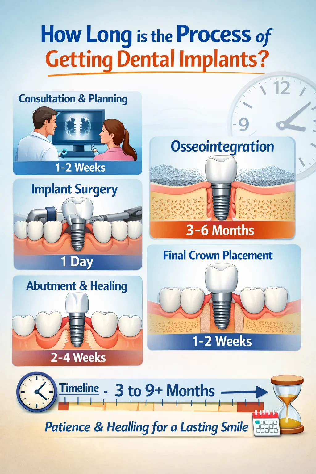 How Long Is the Process of Getting Dental Implants 5 how long is the process of getting dental implants