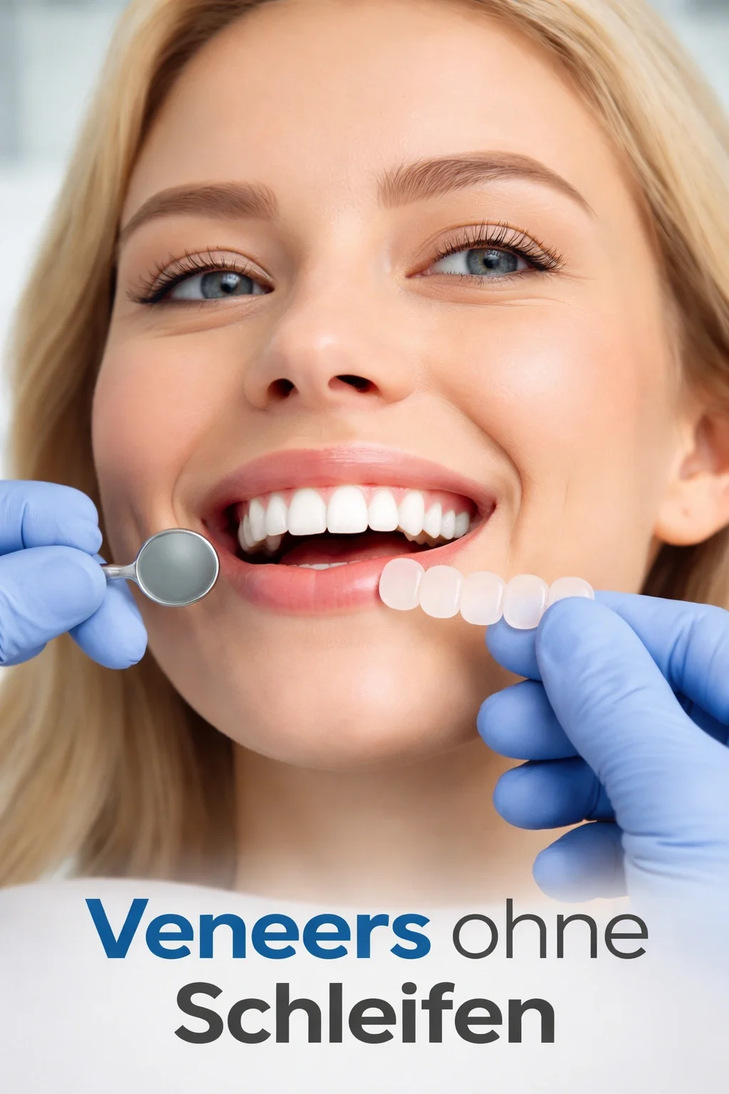 Veneers ohne Schleifen: Schonende Ästhetik für schöne Zähne 5 veneers ohne schleifen