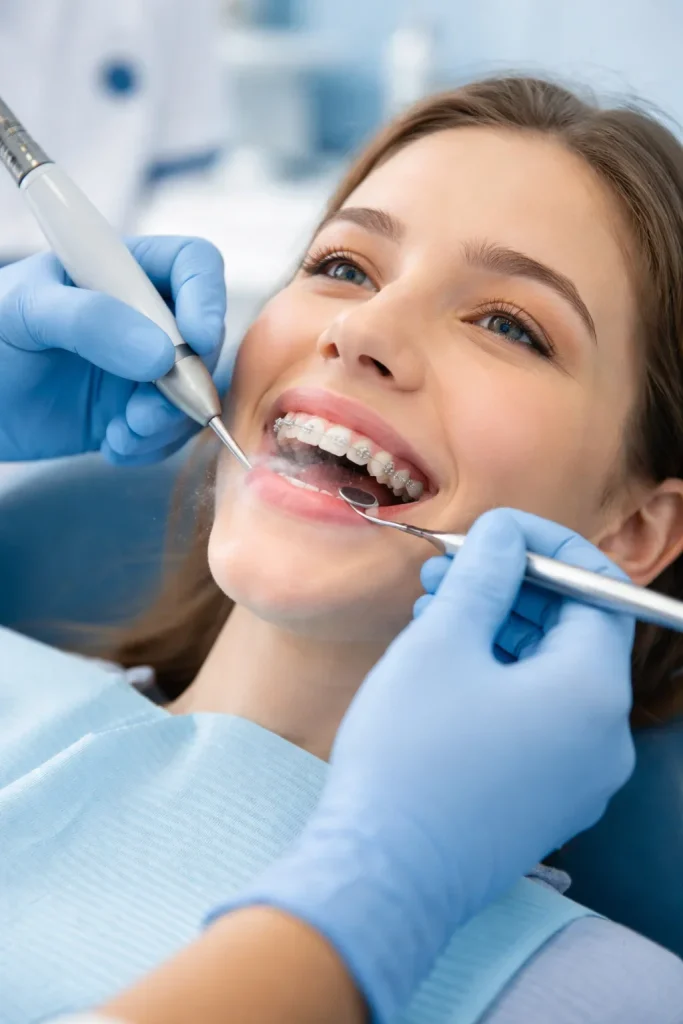 Can U Get Your Teeth Cleaned with Braces? 4 can u get your teeth cleaned with braces