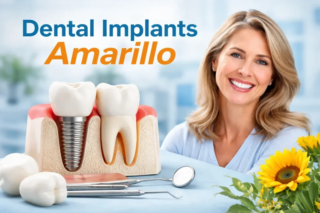 Dental Implants Amarillo: A Complete Patient Guide 4 dental implants amarillo