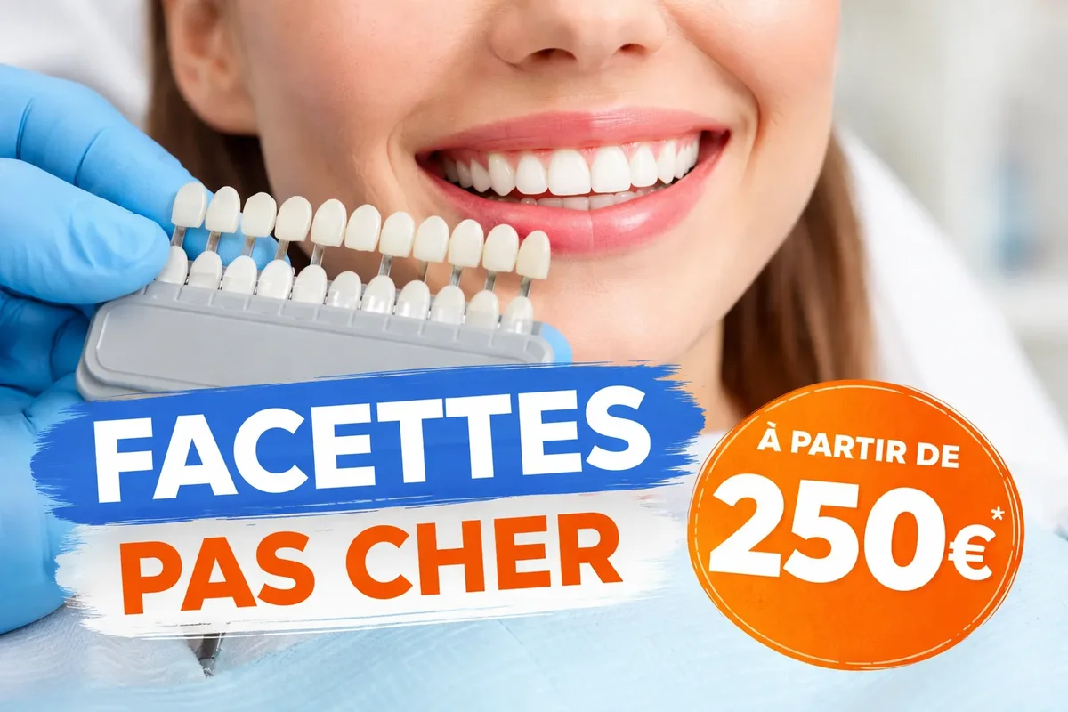Facettes pas cher : guide complet pour un sourire parfait 5 facettes pas cher