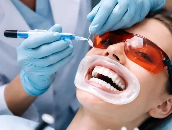 Bleaching Gel Zahnarzt: Wirkung, Ablauf und Vorteile 20 bleaching gel zahnarzt